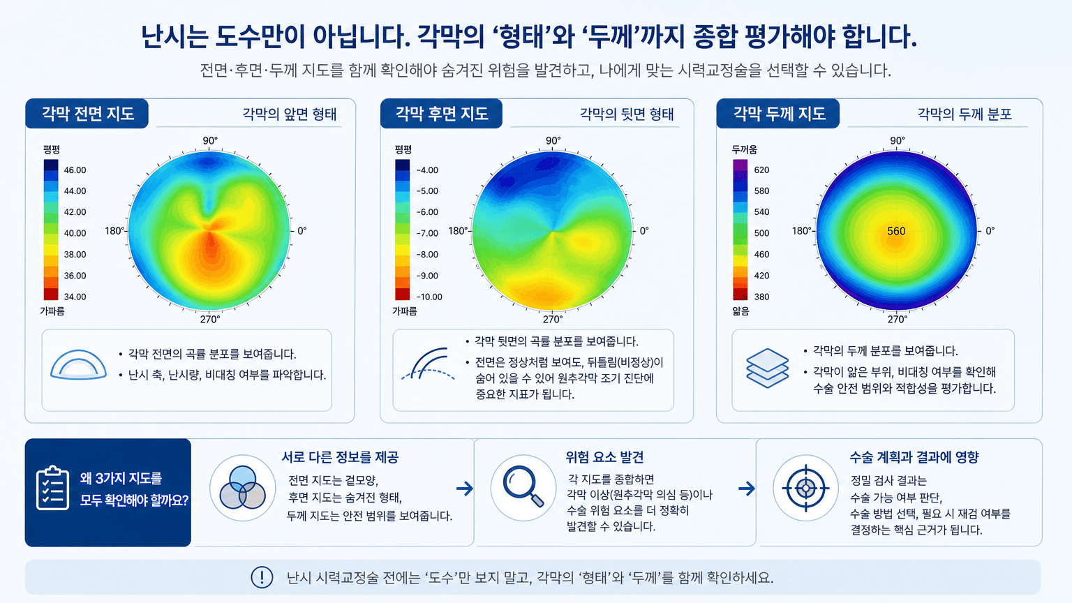 난시 도수와 각막 형태 검사가 서로 다른 정보를 준다는 점을 설명