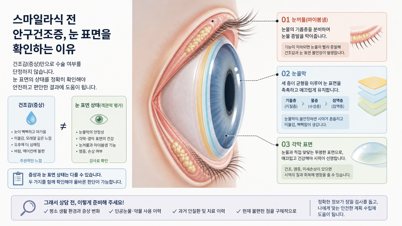 스마일라식 전 안구건조증, 눈 표면을 확인하는 이유