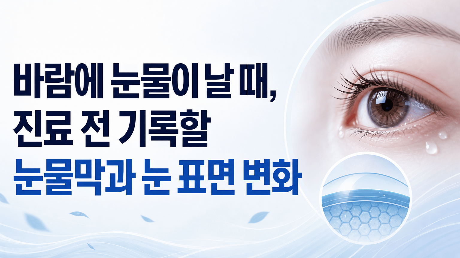 바람에 눈물이 날 때, 진료 전 기록할 눈물막과 눈 표면 변화