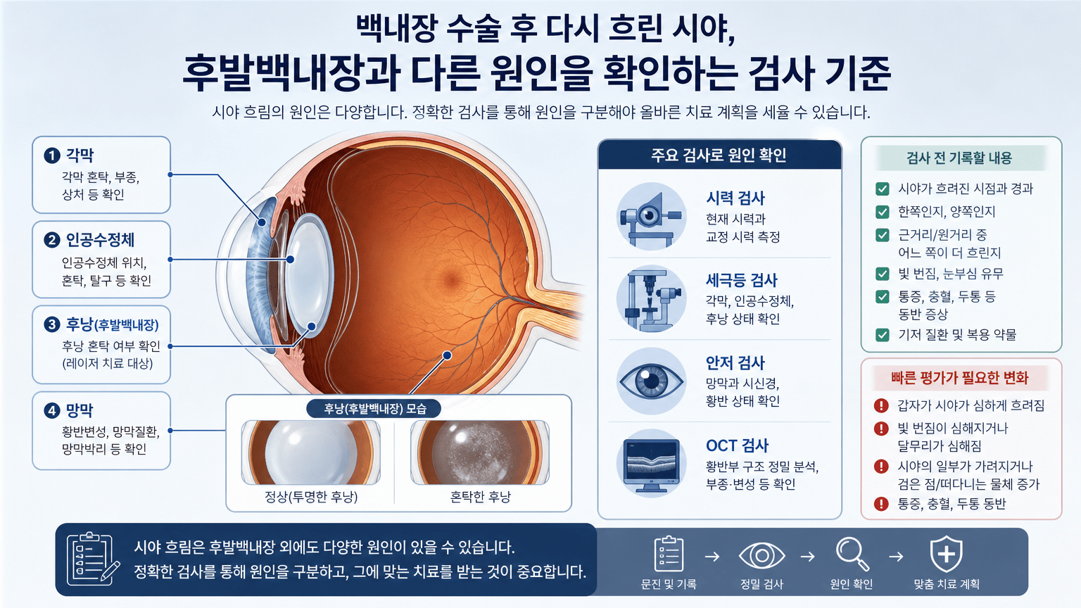 백내장 수술 후 다시 흐린 시야, 후발백내장과 다른 원인을 확인하는 검사 기준